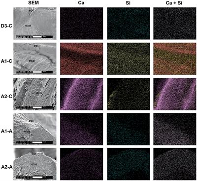 The Initiation and Early Stages of Postmolt Mineralization in the Blue Crab, Callinectes sapidus